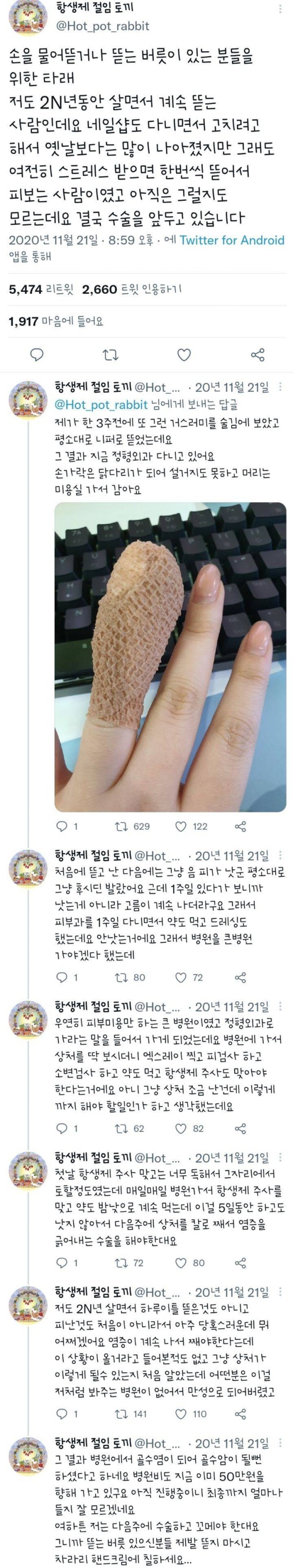 손톱 물어뜯는 버릇을 쉽게 보면 않되는 이유