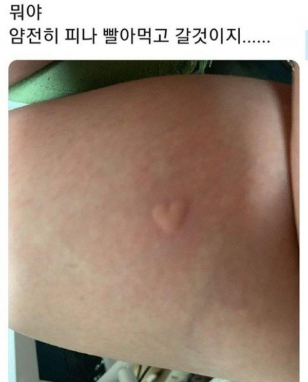 모기가 남긴 흔적 ..ㄷㄷ